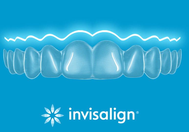 일요일치과 압구정 강남교정치과. 치아교정 라인업; 인비절라인, 클리피씨, 클라리티 울트라. 장점/단점/비용/후기. 관련 이미지 3