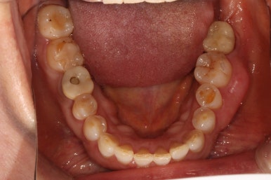치과 전문의가 하는 일 - 치주과, 치과보존과, 치과보철과, 치과교정과 전문의가 있는 치과. 관련 이미지 23