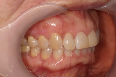 치과 전문의가 하는 일 - 치주과, 치과보존과, 치과보철과, 치과교정과 전문의가 있는 치과. 관련 이미지 18