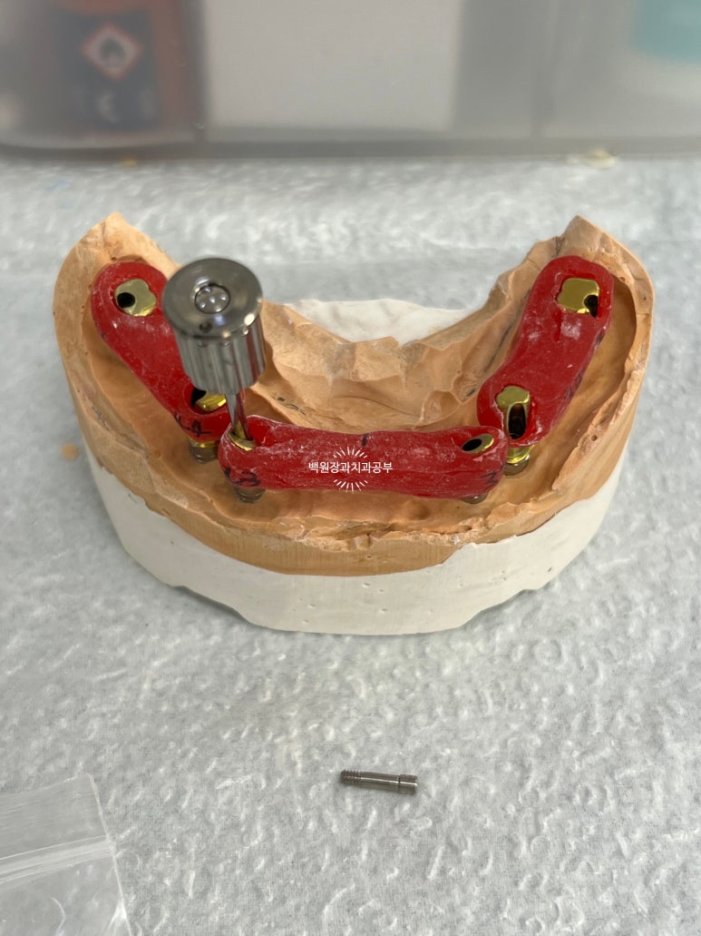 오스템임플란트 네비게이션 전체 임플란트 치료일기. 치료과정/치료기간/비용/솔직후기. 관련 이미지 26