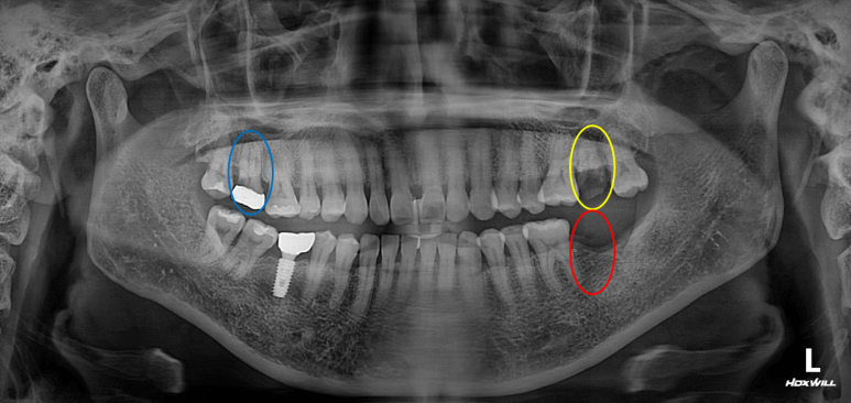 치과 전문의가 하는 일 - 치주과, 치과보존과, 치과보철과, 치과교정과 전문의가 있는 치과. 관련 이미지 5