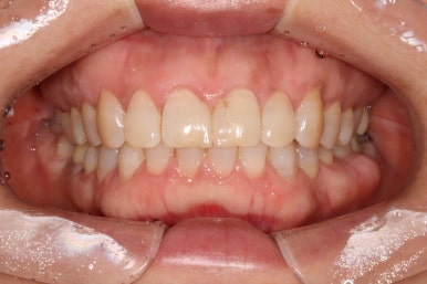 치과 전문의가 하는 일 - 치주과, 치과보존과, 치과보철과, 치과교정과 전문의가 있는 치과. 관련 이미지 16