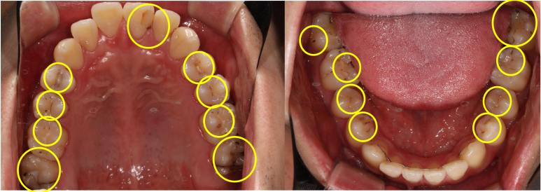 치과의 과잉진료에 대하여. 나는 양심 치과의사인가? 관련 이미지 3