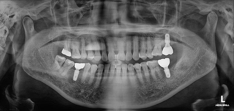 치과 전문의가 하는 일 - 치주과, 치과보존과, 치과보철과, 치과교정과 전문의가 있는 치과. 관련 이미지 14