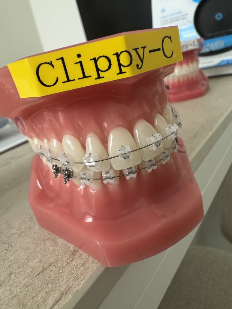 일요일치과 압구정 강남교정치과. 치아교정 라인업; 인비절라인, 클리피씨, 클라리티 울트라. 장점/단점/비용/후기. 관련 이미지 7