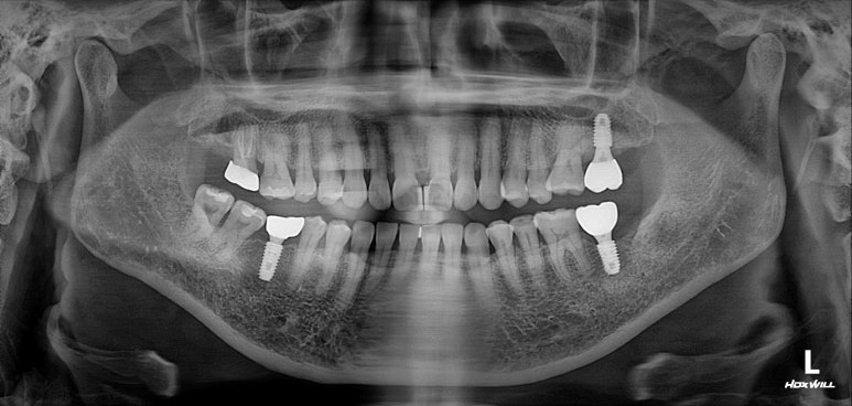 치과 전문의가 하는 일 - 치주과, 치과보존과, 치과보철과, 치과교정과 전문의가 있는 치과. 관련 이미지 21