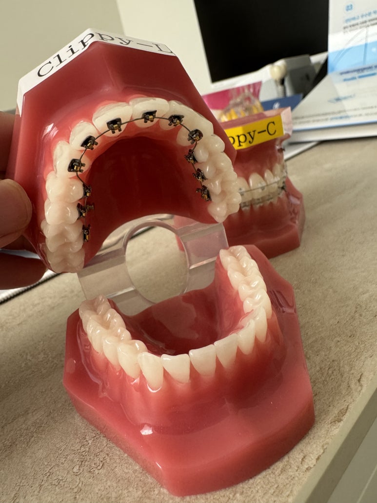 일요일치과 압구정 강남교정치과. 치아교정 라인업; 인비절라인, 클리피씨, 클라리티 울트라. 장점/단점/비용/후기. 관련 이미지 9