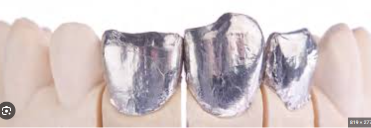 레브네이트 마스터 ; 예비신랑 앞니 무삭제라미네이트. 신사역 치과. 치료후기/비용/가격. 관련 이미지 18