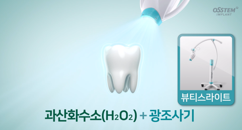 강남 치아미백 성지 레브치과. 가격/비용/부작용/전후사진. 관련 이미지 6