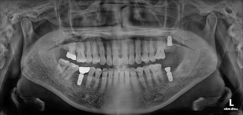 치과 전문의가 하는 일 - 치주과, 치과보존과, 치과보철과, 치과교정과 전문의가 있는 치과. 관련 이미지 13