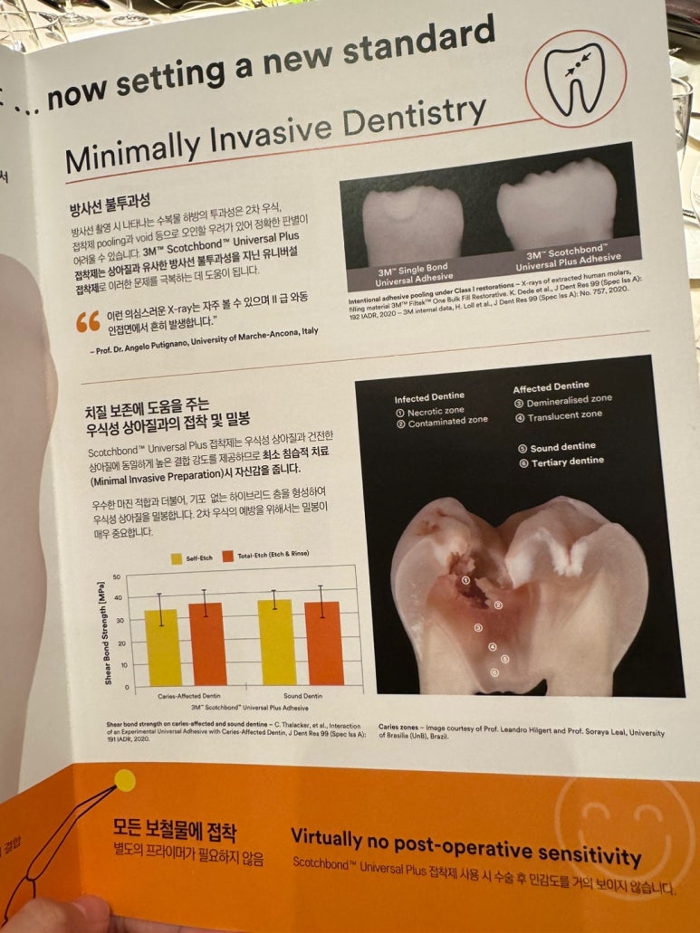 치과용 3M 신제품 런칭 행사에 초청되어, 신라호텔 영빈관 디너코스와 함께. 3M RelyX Universal. 관련 이미지 11