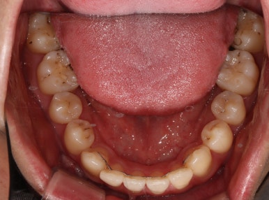 치과의 과잉진료에 대하여. 나는 양심 치과의사인가? 관련 이미지 2