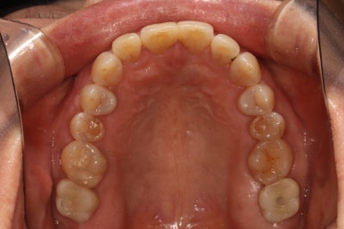 치과 전문의가 하는 일 - 치주과, 치과보존과, 치과보철과, 치과교정과 전문의가 있는 치과. 관련 이미지 22