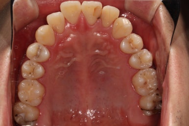 치과의 과잉진료에 대하여. 나는 양심 치과의사인가? 관련 이미지 1
