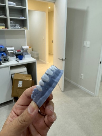 강남 원데이 라미네이트! 주7일 투명교정! 임플란트 바로 심어주는 치과! 신사 레브치과 GRAND OPEN! 인테리어 치과시설 둘러보기~ 관련 이미지 29