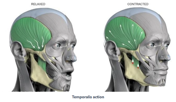 이갈이 마우스피스를 맞추기 전에, 저작근을 이해하고 측두근 보톡스를 맞아보세요! 관련 이미지 3