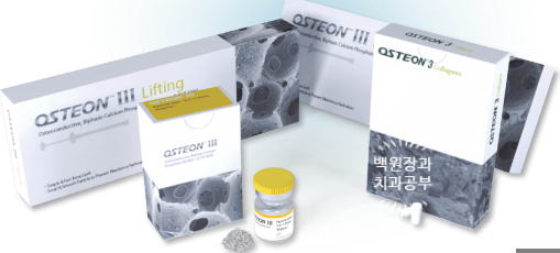 치아와 임플란트를 연결하면 치아가 망가집니다. 발치 동시 치조골 이식 후 임플란트. 치료과정/치료기간/비용/후기. 관련 이미지 8