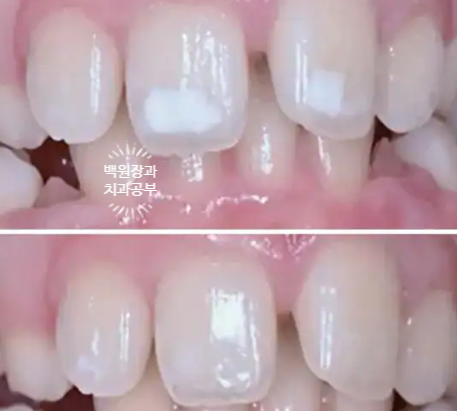 서울 신사역 [레브치과] 20명이 동시에 치아미백을 할 수 있는 치과가 여기있습니다. 관련 이미지 7