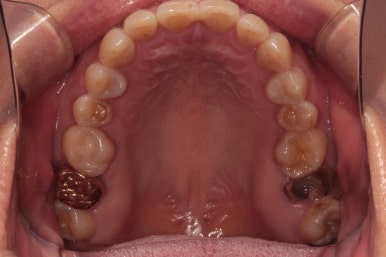 치과 전문의가 하는 일 - 치주과, 치과보존과, 치과보철과, 치과교정과 전문의가 있는 치과. 관련 이미지 9