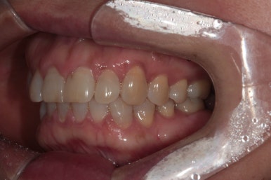 치과 전문의가 하는 일 - 치주과, 치과보존과, 치과보철과, 치과교정과 전문의가 있는 치과. 관련 이미지 8