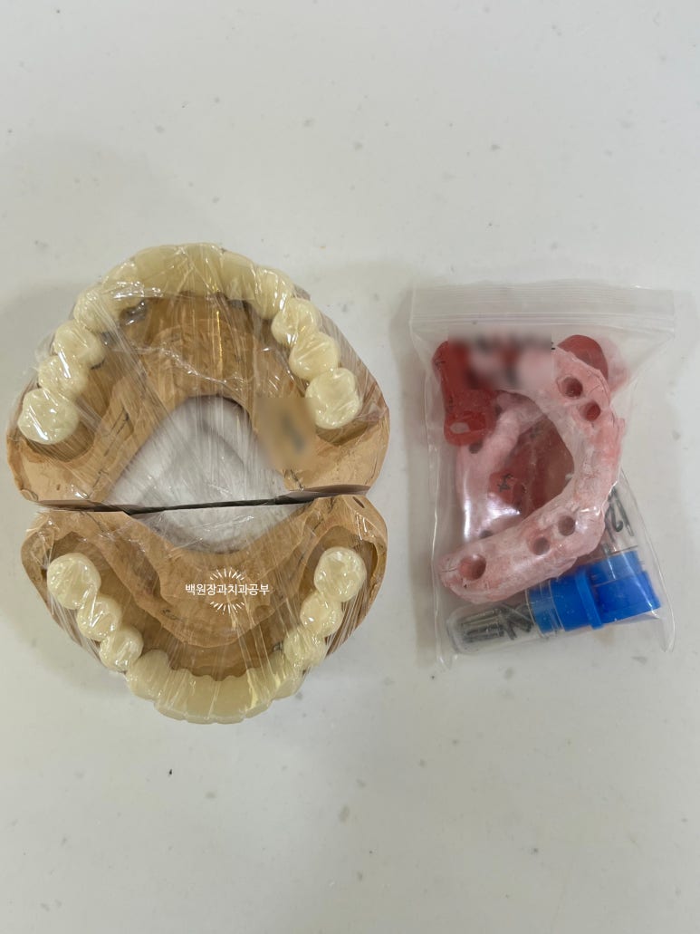 오스템임플란트 네비게이션 전체 임플란트 치료일기. 치료과정/치료기간/비용/솔직후기. 관련 이미지 19