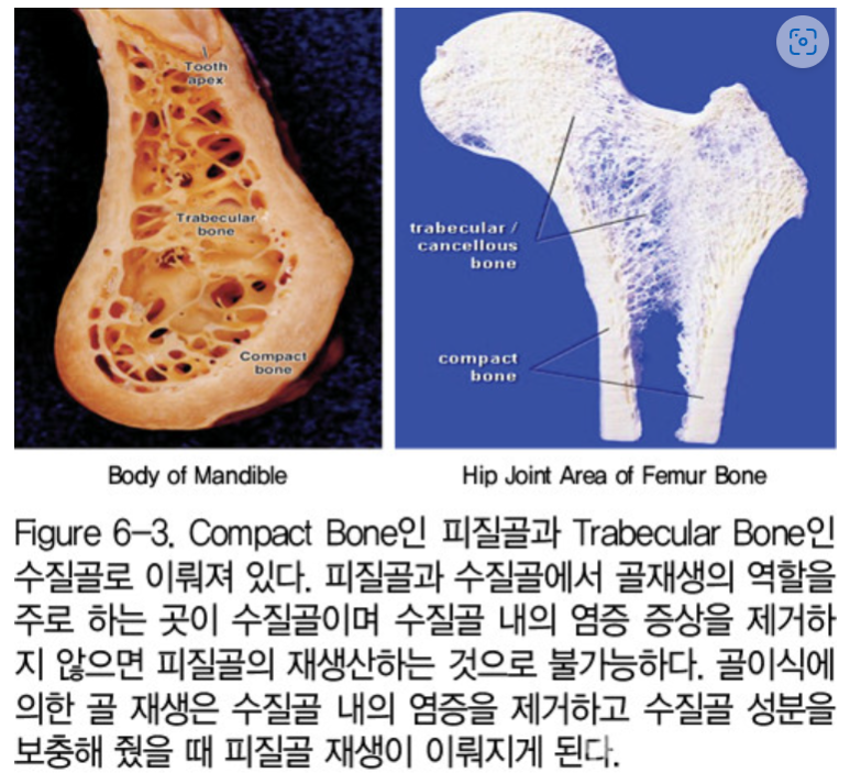 오스템임플란트 네비게이션 전체 임플란트 치료일기. 치료과정/치료기간/비용/솔직후기. 관련 이미지 6