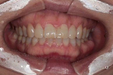 치과 전문의가 하는 일 - 치주과, 치과보존과, 치과보철과, 치과교정과 전문의가 있는 치과. 관련 이미지 7