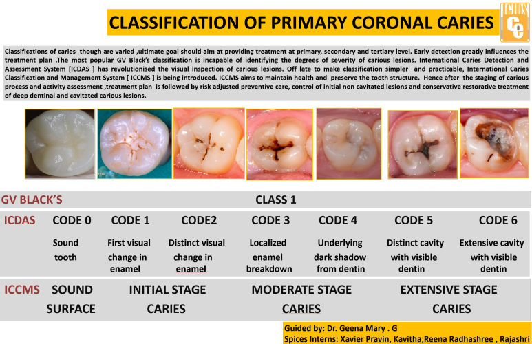 치과의 과잉진료에 대하여. 나는 양심 치과의사인가? 관련 이미지 4