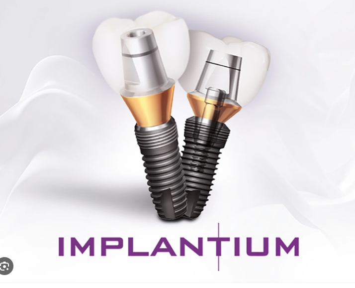 신사역 레브치과 임플란트 라인업. 관련 이미지 2