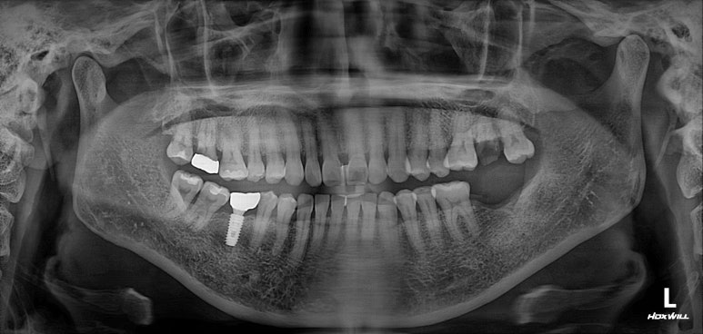치과 전문의가 하는 일 - 치주과, 치과보존과, 치과보철과, 치과교정과 전문의가 있는 치과. 관련 이미지 4