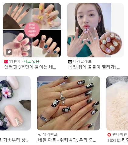 앞니레진치료 할 줄 모르는 치과의사는 없지만, 좋은 레진으로 치료하는 치과의사는 잘 없습니다. 관련 이미지 2