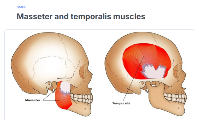 이갈이 마우스피스를 맞추기 전에, 저작근을 이해하고 측두근 보톡스를 맞아보세요! 관련 이미지 4