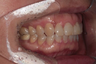 치과 전문의가 하는 일 - 치주과, 치과보존과, 치과보철과, 치과교정과 전문의가 있는 치과. 관련 이미지 6