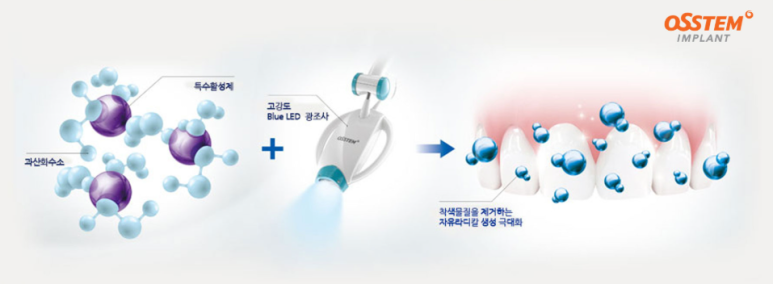 치과에서 치아미백 vs 셀프치아미백 기본적으로 효과 차이가 큽니다. 가로수길 미백성지 추천/효과/비용/가격/기계. 관련 이미지 4