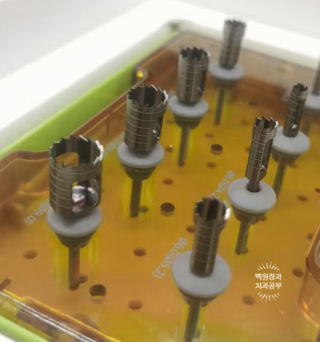 임플란트에서 고름이 나와요. 임플란트 주위염 그리고 재수술을 위한 준비. 치료과정/치료기간/비용/후기. 관련 이미지 15