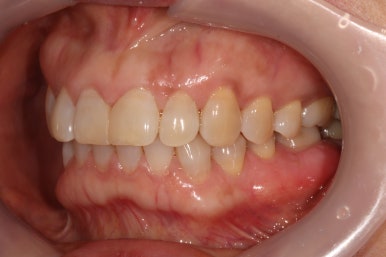 치과 전문의가 하는 일 - 치주과, 치과보존과, 치과보철과, 치과교정과 전문의가 있는 치과. 관련 이미지 20