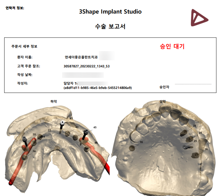 아래 어금니 임플란트 6개면 틀니를 안써도 됩니다.  치주염 전문 착한치과. 치료기간/임시치아과정/후기/비용. 관련 이미지 9