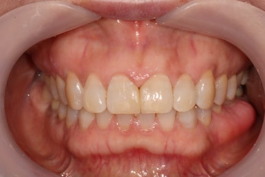 치과 전문의가 하는 일 - 치주과, 치과보존과, 치과보철과, 치과교정과 전문의가 있는 치과. 관련 이미지 17