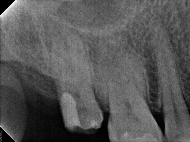 치과 전문의가 하는 일 - 치주과, 치과보존과, 치과보철과, 치과교정과 전문의가 있는 치과. 관련 이미지 11