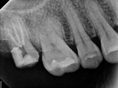 치과 전문의가 하는 일 - 치주과, 치과보존과, 치과보철과, 치과교정과 전문의가 있는 치과. 관련 이미지 12