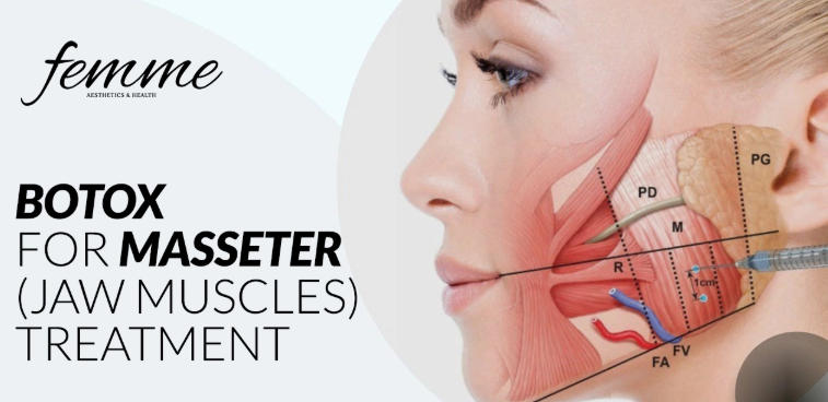 이갈이보톡스를 치과에서 치료받아야 하는 이유. 코어톡스 가격 주기 부작용 정보. 관련 이미지 8