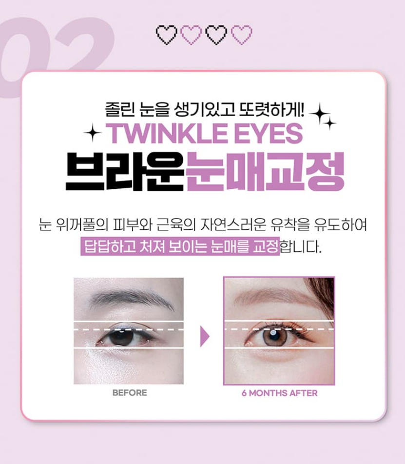 브라운성형외과 올인원 눈성형 :: 오직 나를 위한 착붙라인! 관련 이미지 5