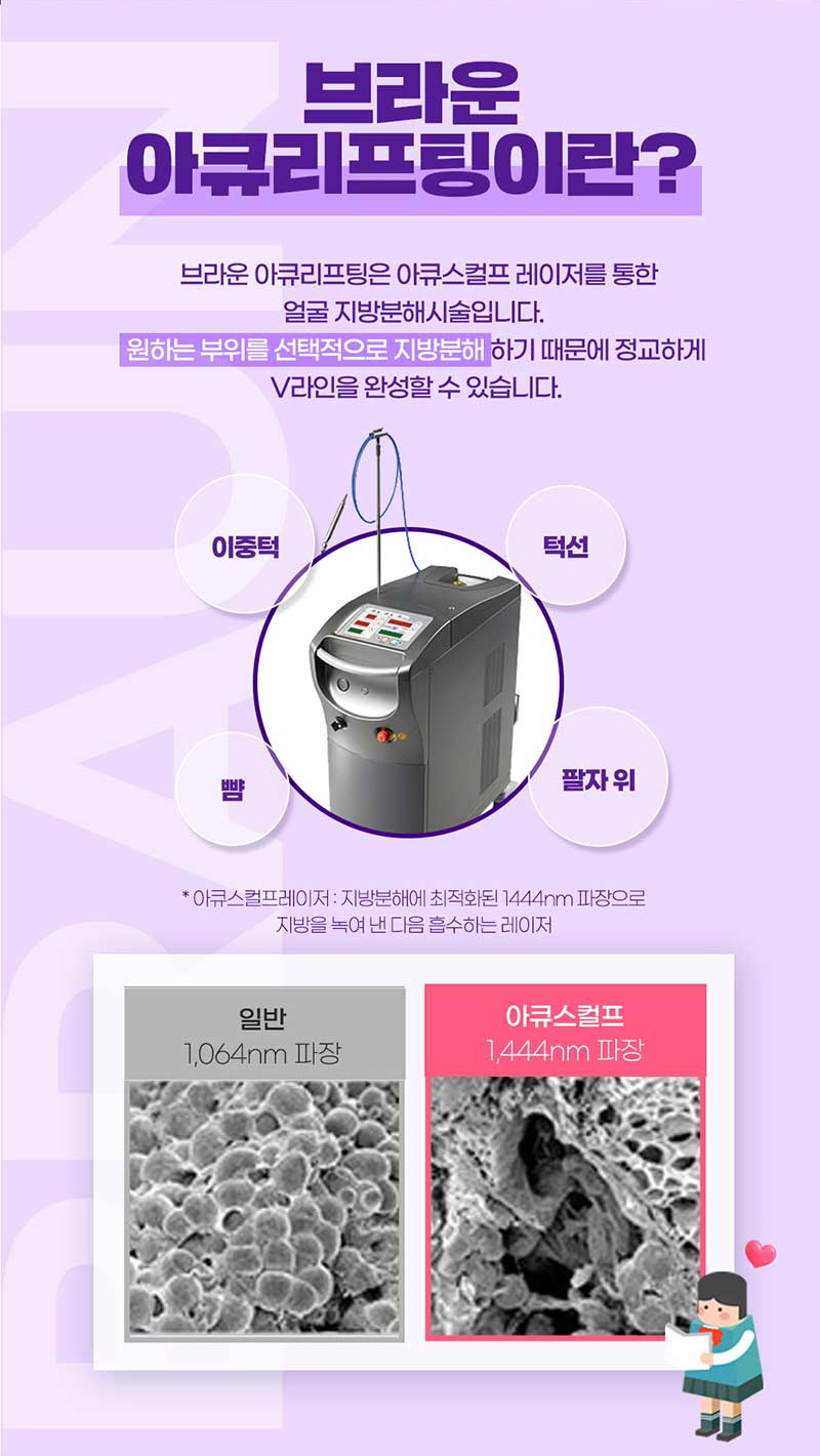 브라운성형외과 아큐리프팅 :: 내 얼굴의 V라인을 찾자 관련 이미지 2
