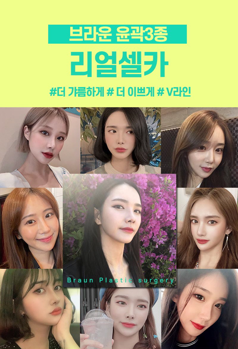 브라운성형외과 윤곽 3종 :: 윤곽 3종하고 v라인 찾자 관련 이미지 5
