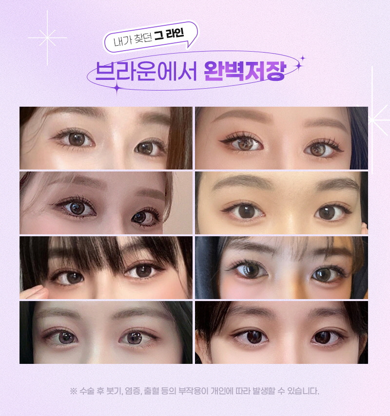 자연스러운 눈의 예쁜 비율 브라운 자연유착 관련 이미지 7