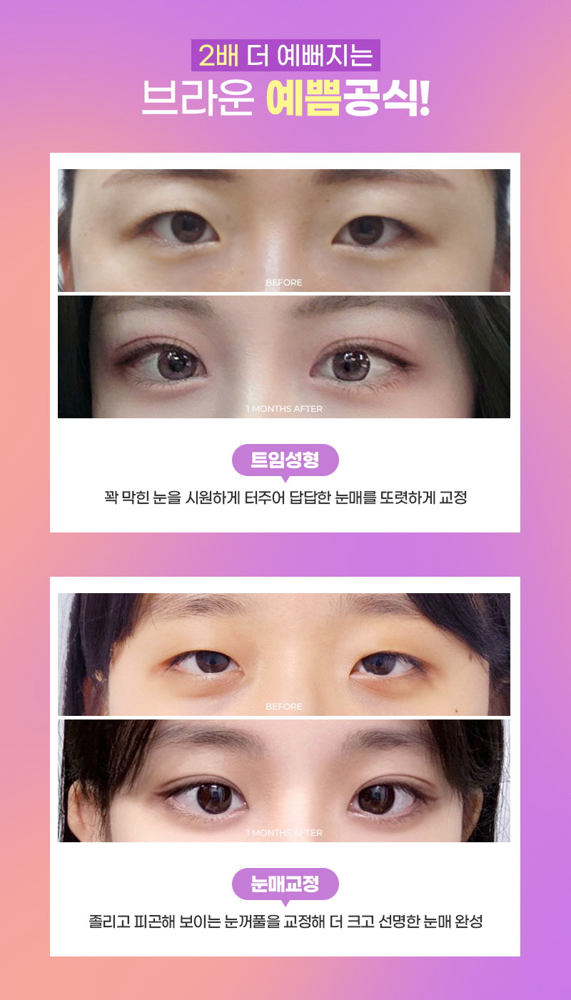 자연스러운 눈의 예쁜 비율 브라운 자연유착 관련 이미지 4