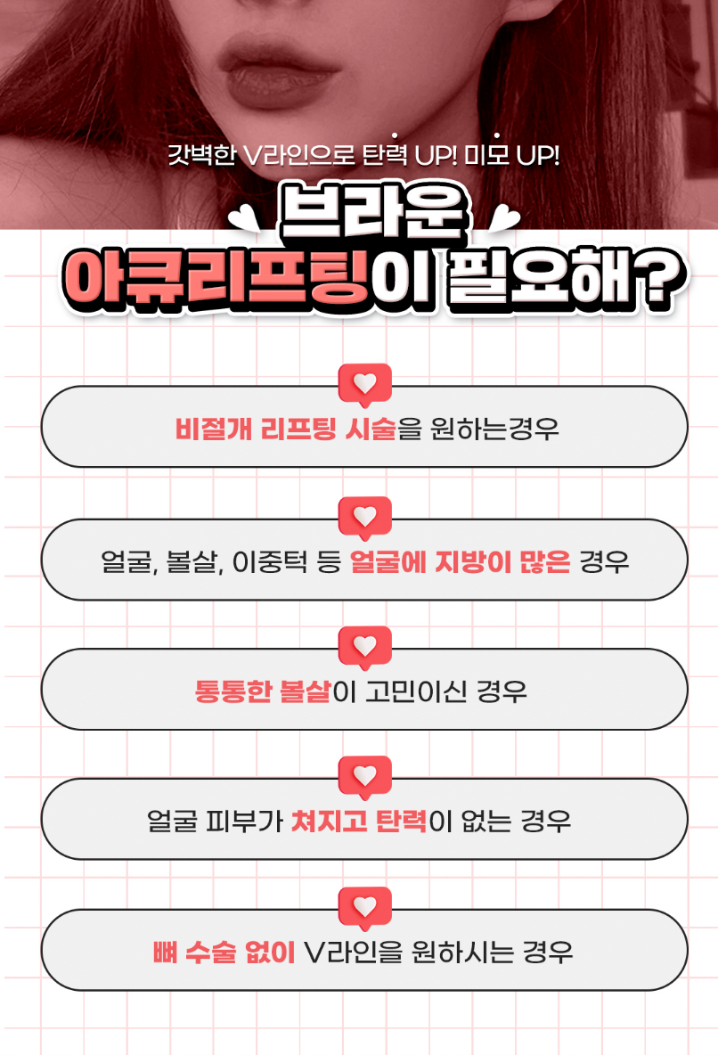 브라운성형외과 아큐리프팅 :: 군살 없이 갸름한 v라인 얼굴 관련 이미지 3