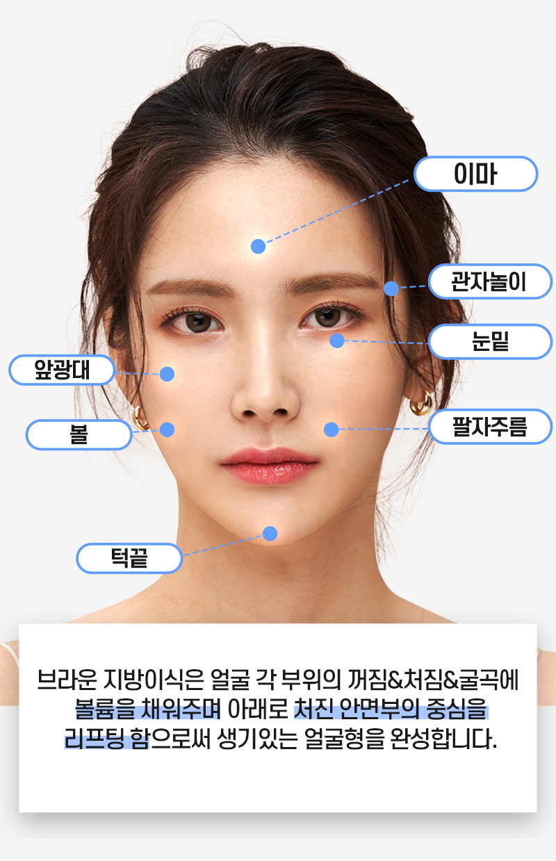 브라운성형외과 얼굴지방이식 :: 입체감 있게 예쁜 내 얼굴 관련 이미지 5
