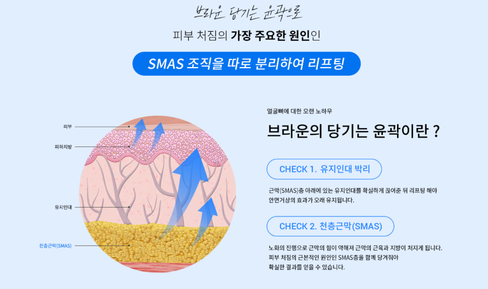 브라운성형외과 당기는 안면윤곽 :: 리프팅과 윤곽을 동시에! 관련 이미지 5