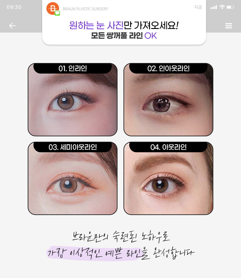 자연스러운 눈의 예쁜 비율 브라운 자연유착 관련 이미지 2